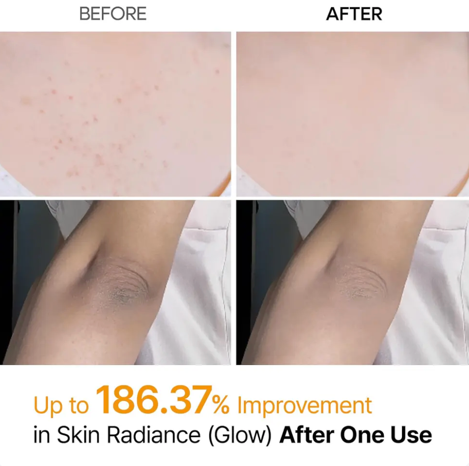 Dr.Melaxin Peel Shot Glow Set - Turmeric Spray & Rice Ampoule Duo™