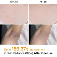 Dr.Melaxin Peel Shot Glow Set - Turmeric Spray & Rice Ampoule Duo™