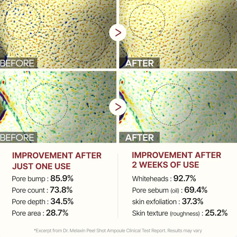 Dr.Melaxin Peel Shot Glow Set - Turmeric Spray & Rice Ampoule Duo™